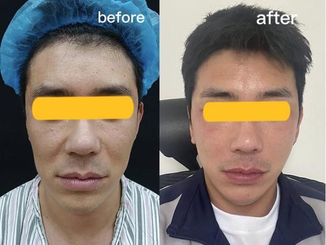 男士美容项目都有哪些项目，男士美容项目都有哪些项目名称？